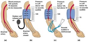 How Blood Pressure is Measured 300x142 - How-Blood-Pressure-is-Measured